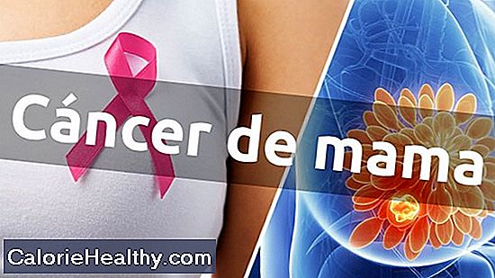 Síntomas del cáncer de mama inflamatorio
